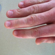 Image for article titled Confessions Of A Nail-Biter